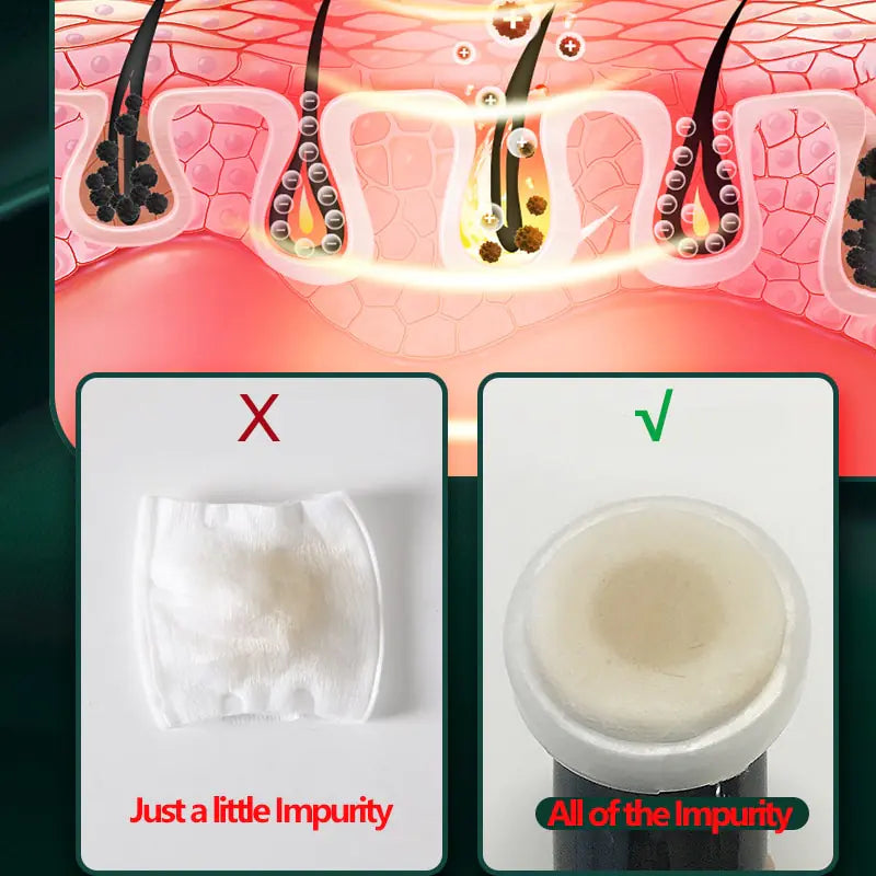 Ultrasonic Skin Scrubber KIT - Pore Cleaner Facial Ion Deep Face Cleaning Sonic Peeling Tools EMS Mesotherapy